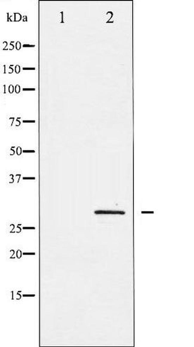 Phospho-SNAI1 (Ser246) Antibody in Western Blot (WB)