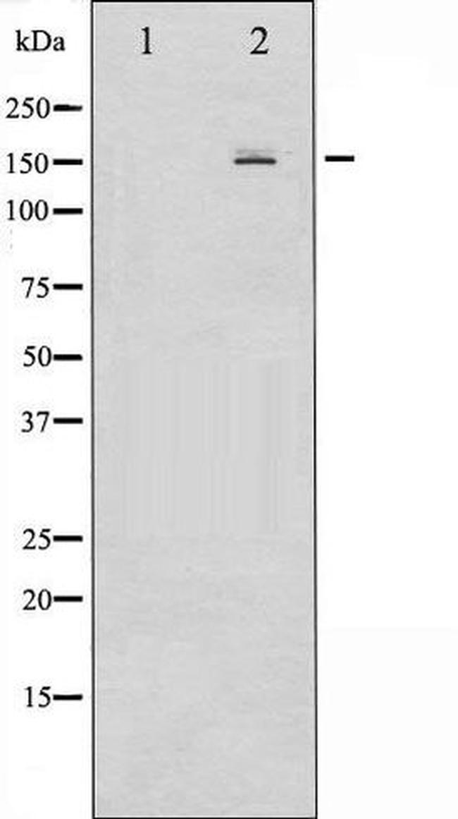 Phospho-EGFR (Ser1026) Antibody in Western Blot (WB)