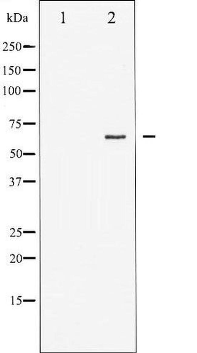 Phospho-Estrogen Receptor alpha (Ser167) Antibody in Western Blot (WB)