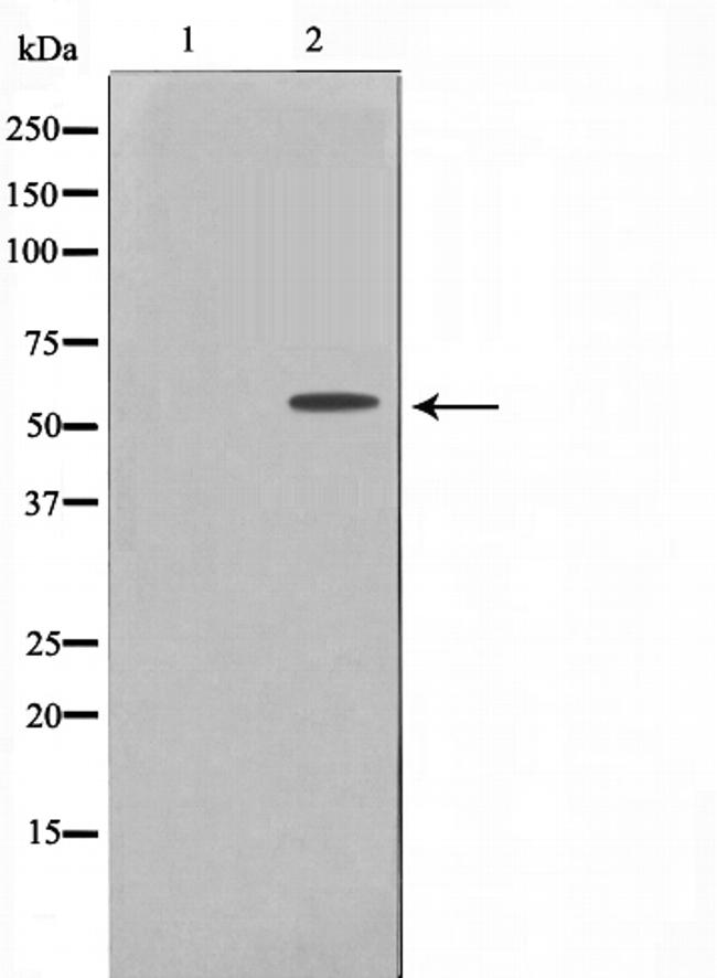 Phospho-Fyn (Tyr530) Antibody in Western Blot (WB)