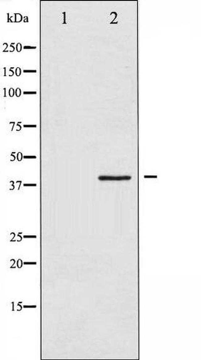 Phospho-hnRNP C1 + C2 (Ser260) Antibody in Western Blot (WB)