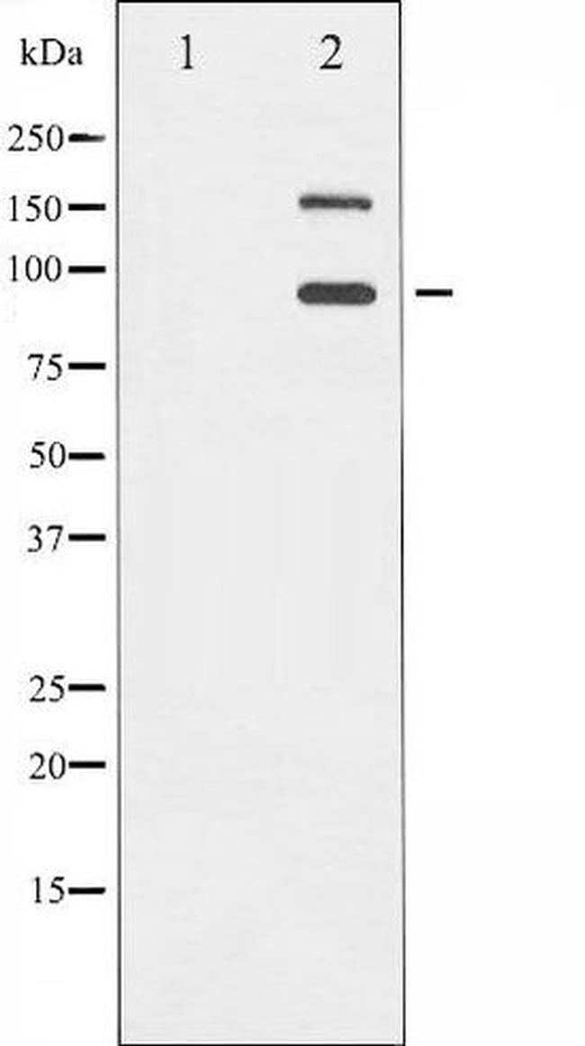 Phospho-IGF1R (Tyr1165, Tyr1166) Antibody in Western Blot (WB)