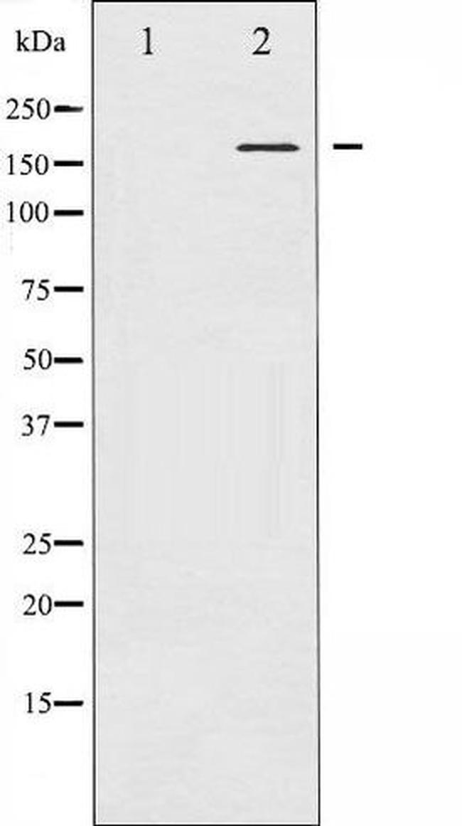 Phospho-Bcr (Tyr177) Antibody in Western Blot (WB)