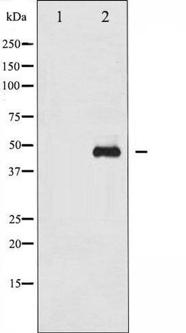 Phospho-GATA1 (Ser310) Antibody in Western Blot (WB)
