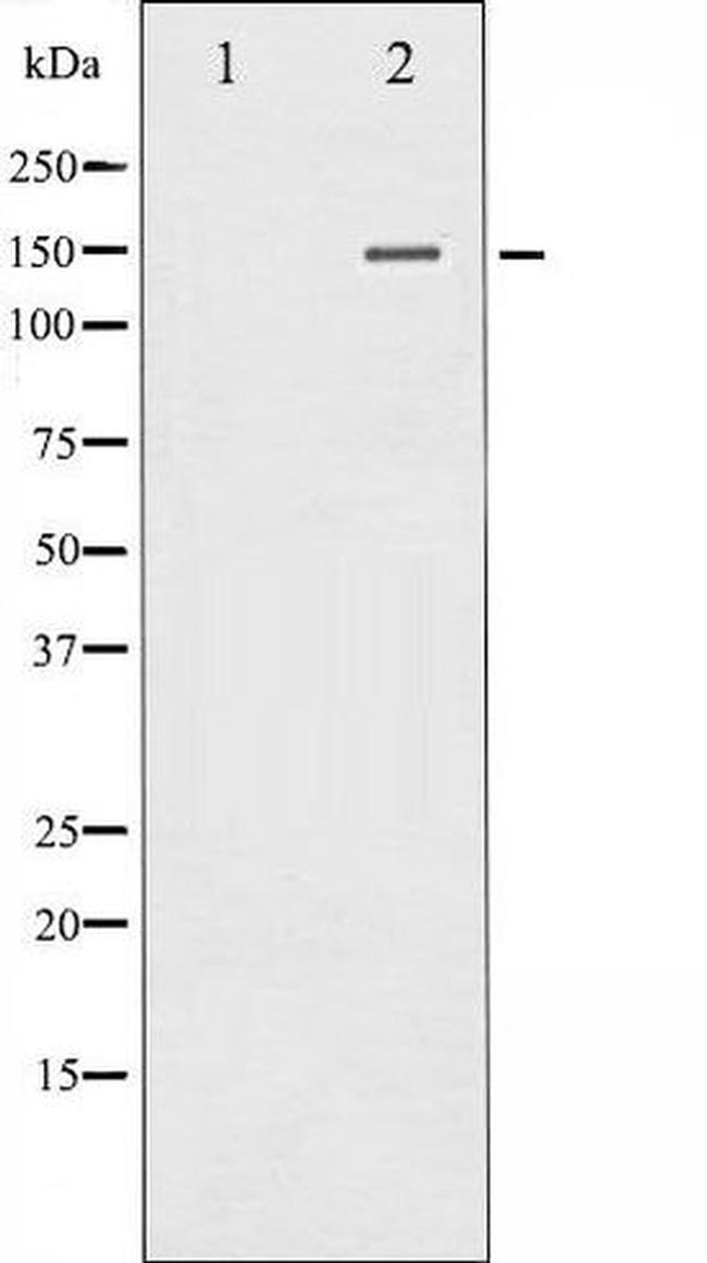 Phospho-PLC gamma 2 (Tyr753) Antibody in Western Blot (WB)