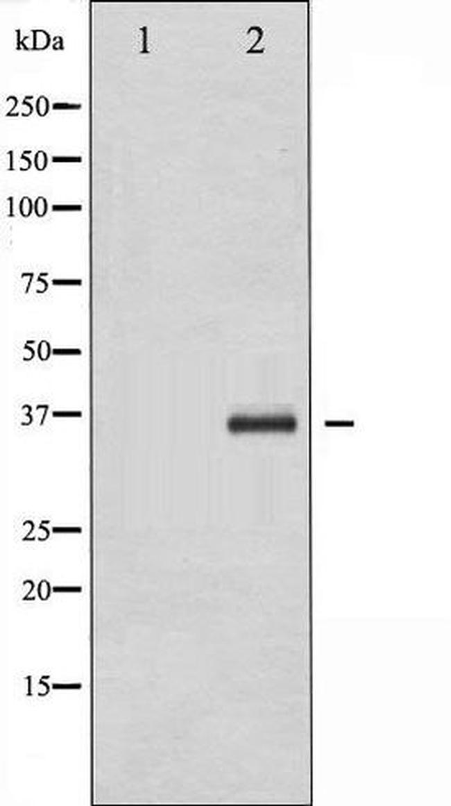 Phospho-CEBP beta (Thr188, Thr235) Antibody in Western Blot (WB)