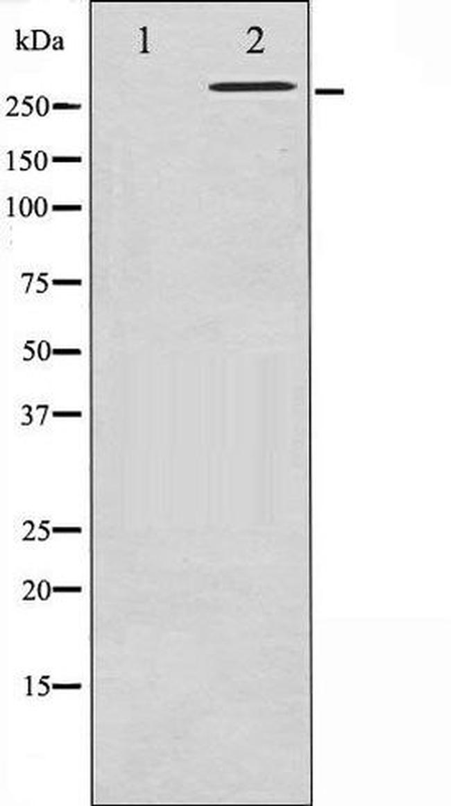Phospho-Filamin A (Ser2152) Antibody in Western Blot (WB)