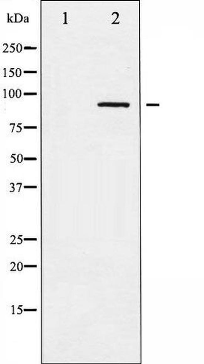 Phospho-ADD1 (Ser726) Antibody in Western Blot (WB)
