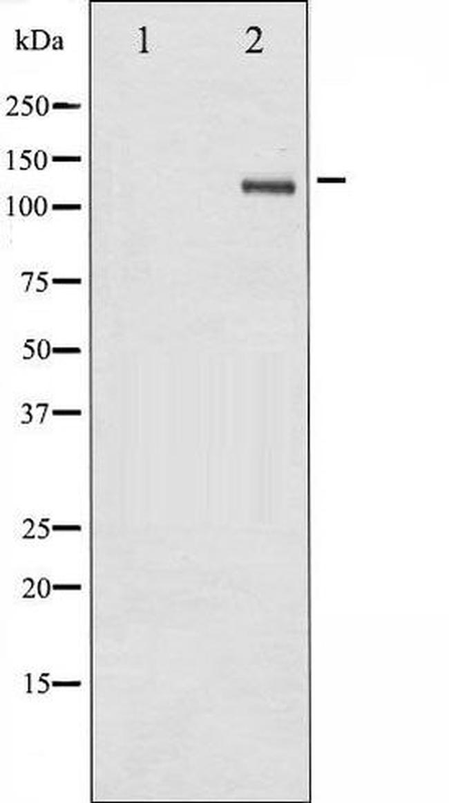 Phospho-SREBP1 (Ser439) Antibody in Western Blot (WB)