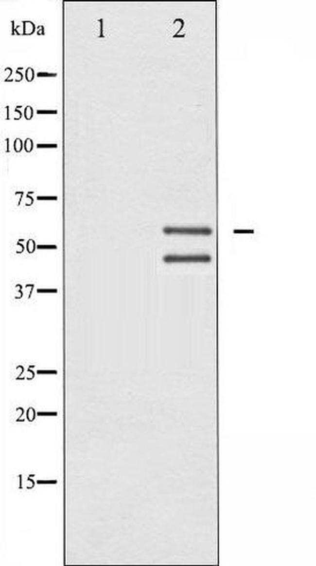 Phospho-JNK1/JNK2/JNK3 (Thr183, Tyr185) Antibody in Western Blot (WB)