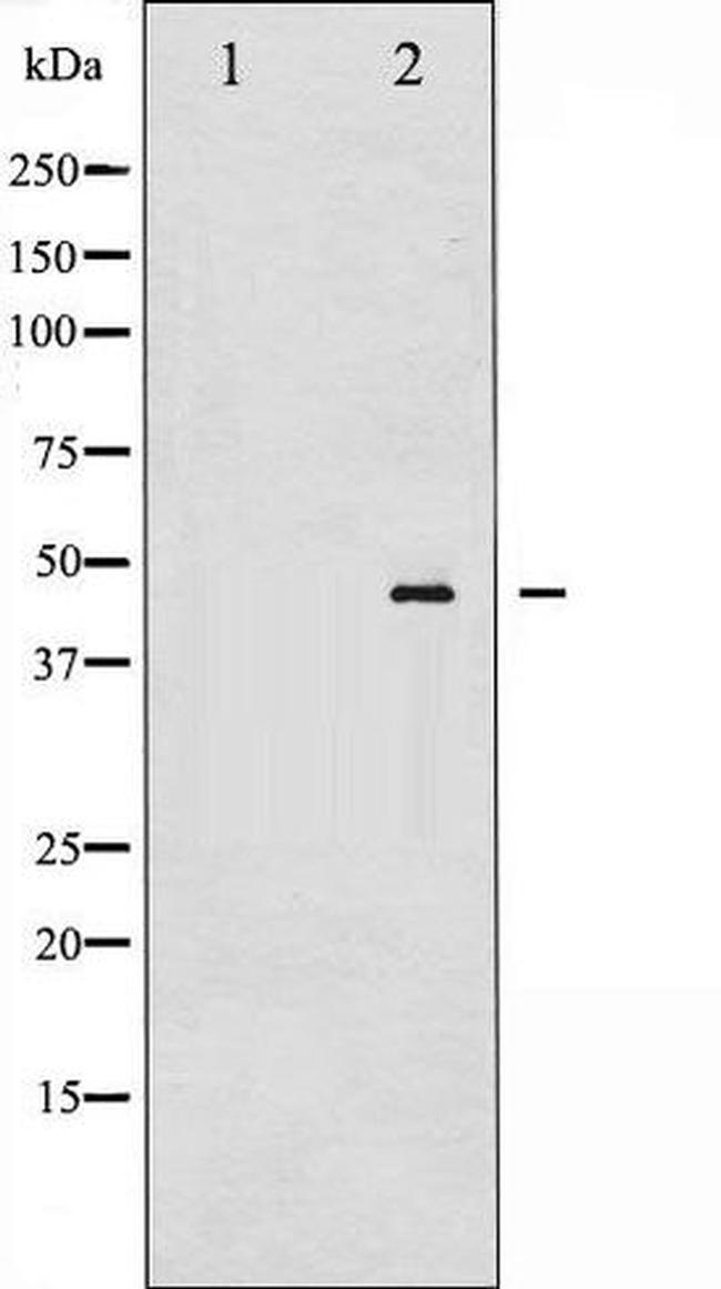 Phospho-MAP2K4 (Thr261) Antibody in Western Blot (WB)
