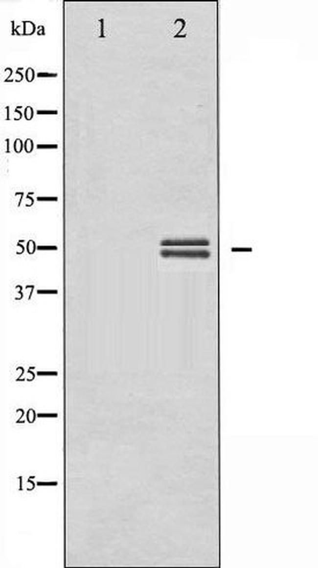 Phospho-GSK3 alpha/beta (Tyr279 , Tyr216) Antibody in Western Blot (WB)