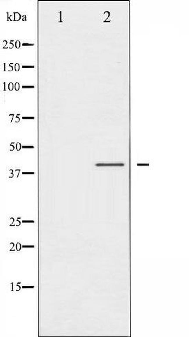 Phospho-CCR5 (Ser336) Antibody in Western Blot (WB)