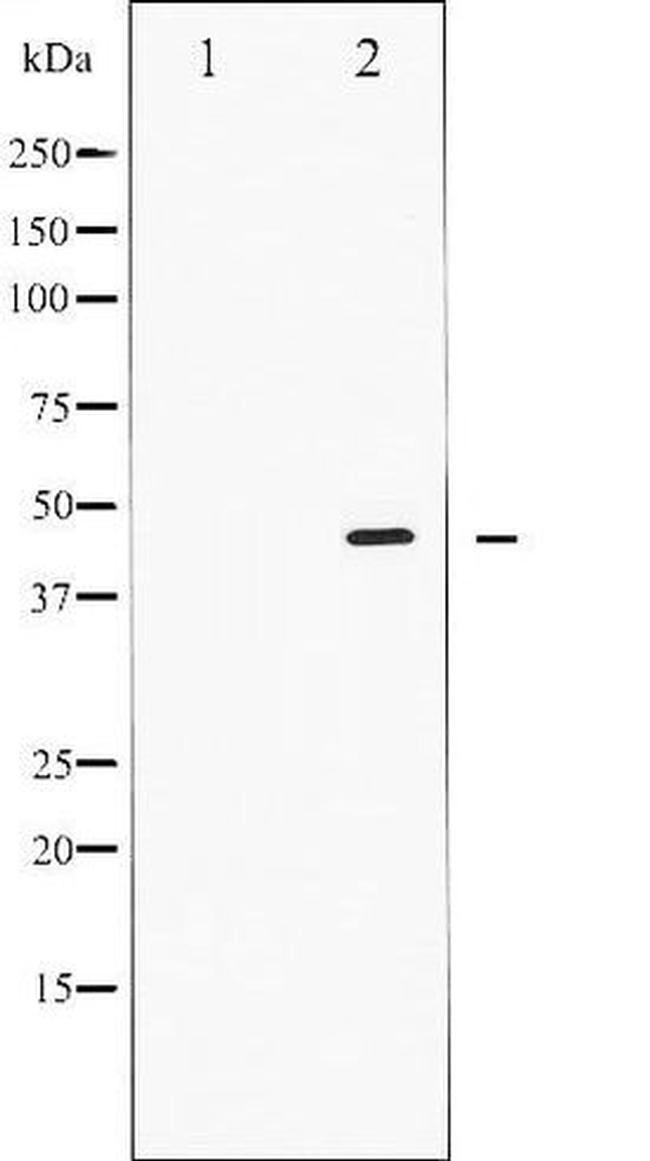 Phospho-SMAD2/SMAD3 (Thr8) Antibody in Western Blot (WB)