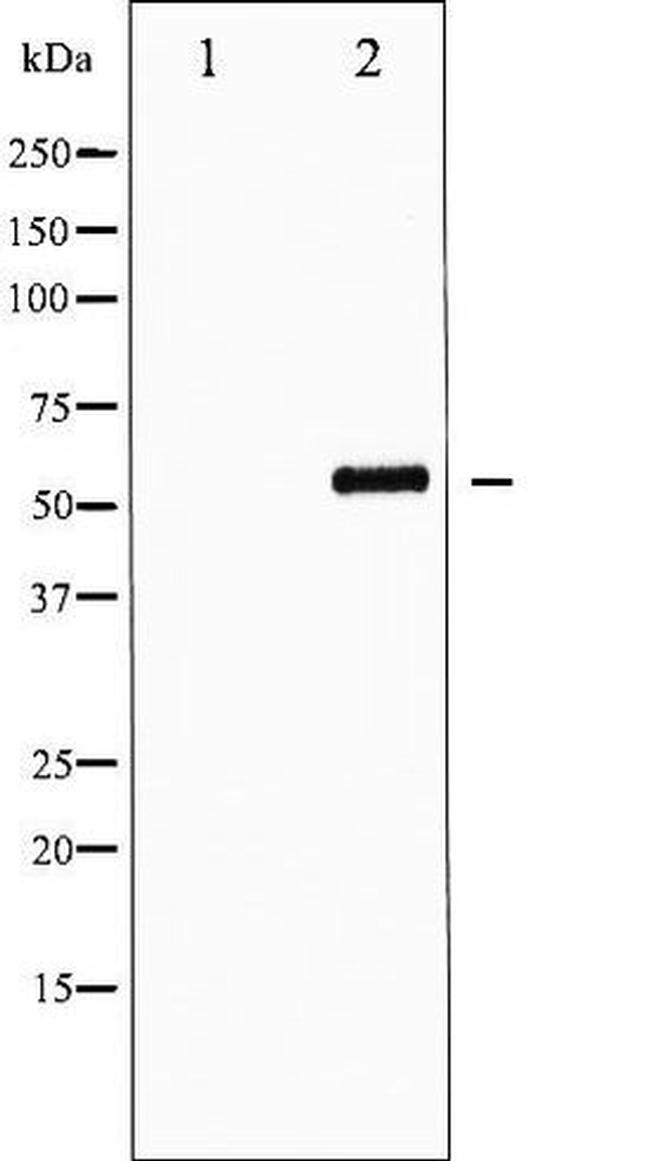 Phospho-FOXO4 (Ser197) Antibody in Western Blot (WB)