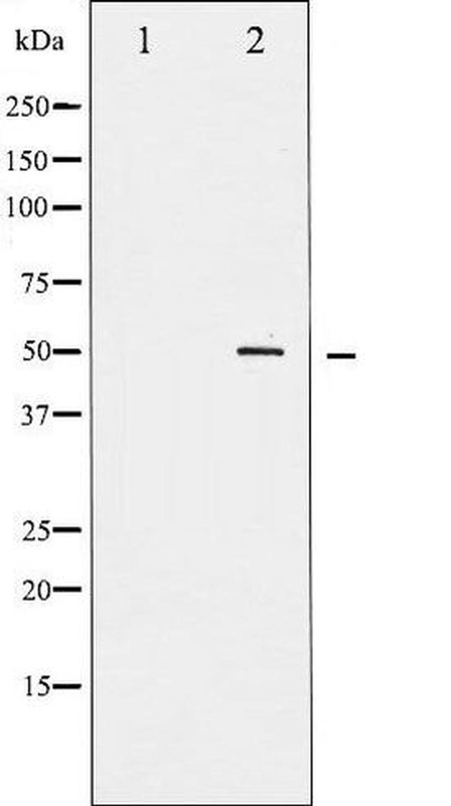 Phospho-RUNX1 / AML1 (Ser303) Antibody in Western Blot (WB)