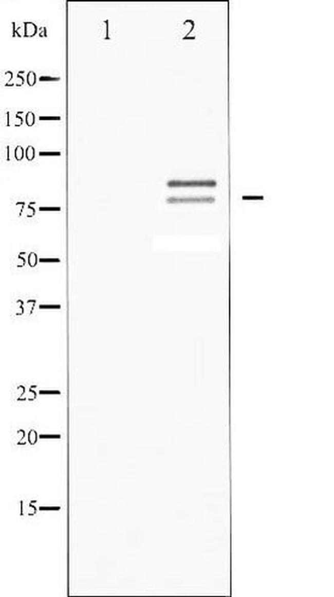 Phospho-Hormone-Sensitive Lipase (Ser554, Ser855) Antibody in Western Blot (WB)