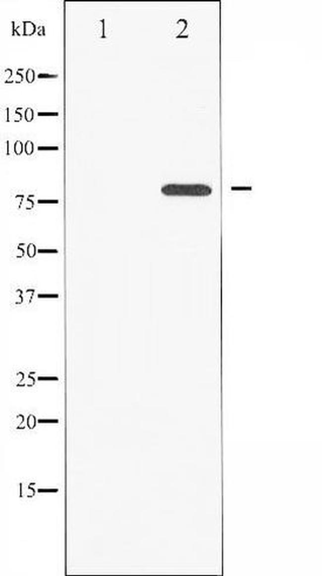 Phospho-PKC zeta (Thr560) Antibody in Western Blot (WB)