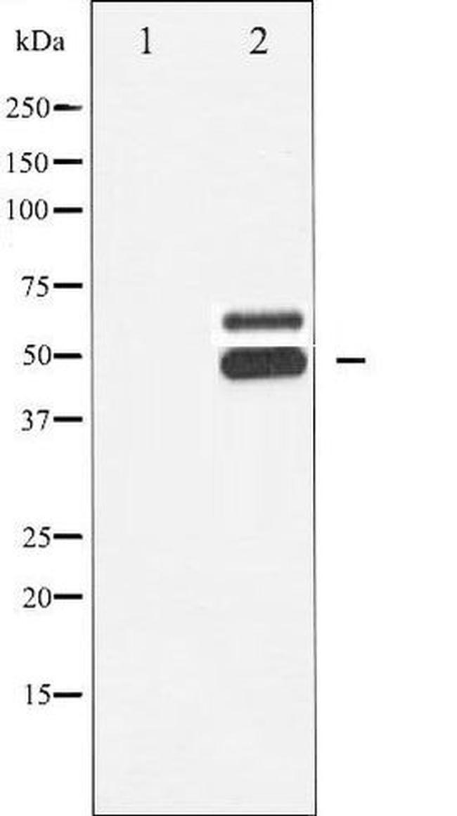 Phospho-CaMKII beta/gamma/delta (Thr287) Antibody in Western Blot (WB)