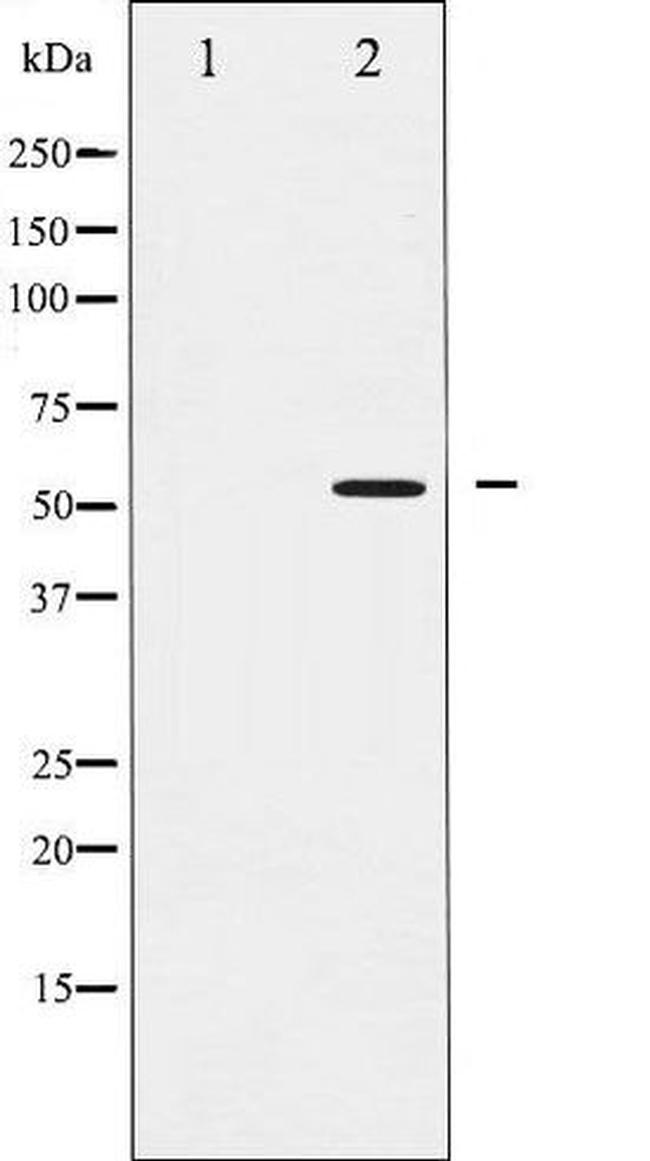 Phospho-SMAD2 (Ser467) Antibody in Western Blot (WB)