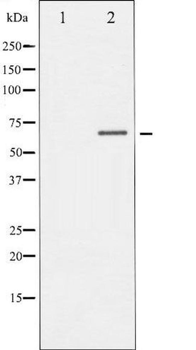 Phospho-CRMP2/DRP-2 (Thr514) Antibody in Western Blot (WB)