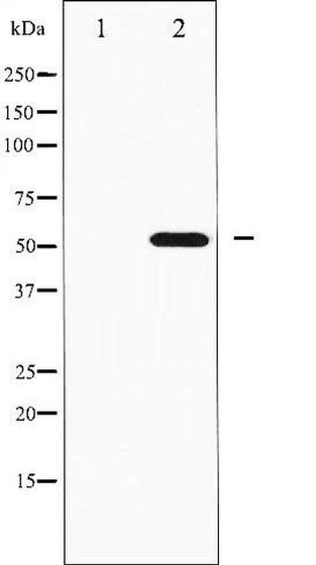Phospho-p70 S6 Kinase beta (Ser423) Antibody in Western Blot (WB)