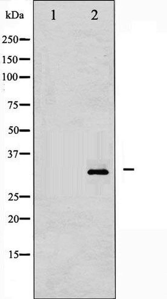 Phospho-DARPP-32 (Thr34) Antibody in Western Blot (WB)