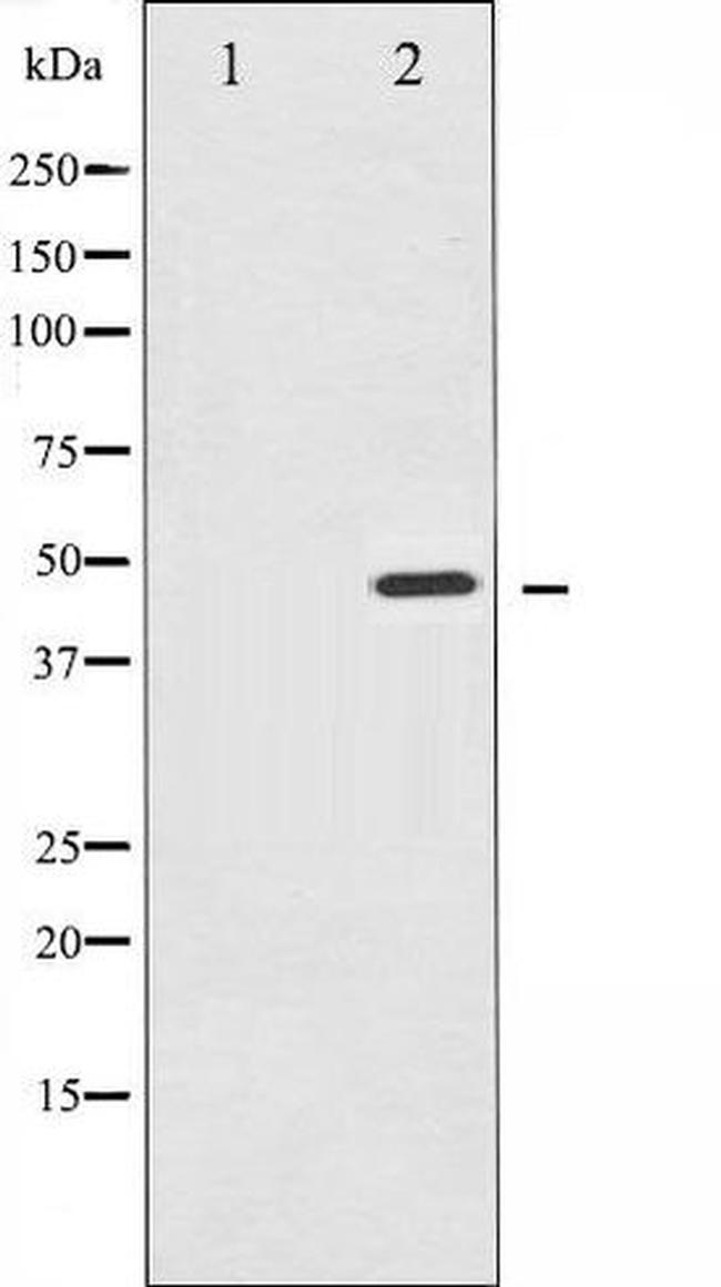 Phospho-IKK gamma (Ser31) Antibody in Western Blot (WB)