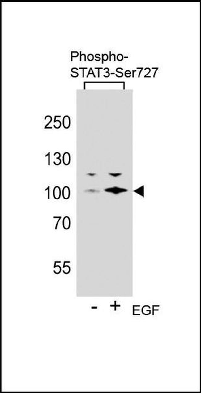 Phospho-STAT3 (Ser727) Antibody in Western Blot (WB)