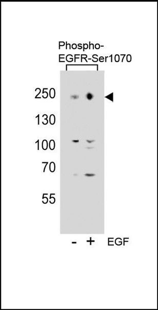 Phospho-EGFR (Ser1070) Antibody in Western Blot (WB)
