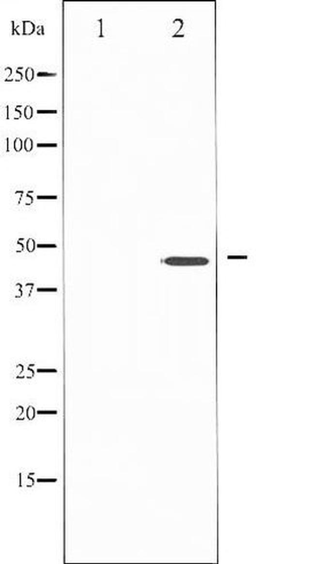 Phospho-IKK-gamma (Ser85) Antibody in Western Blot (WB)