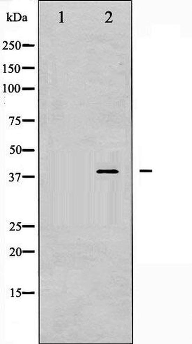Phospho-AMPK beta-1 (Ser181) Antibody in Western Blot (WB)