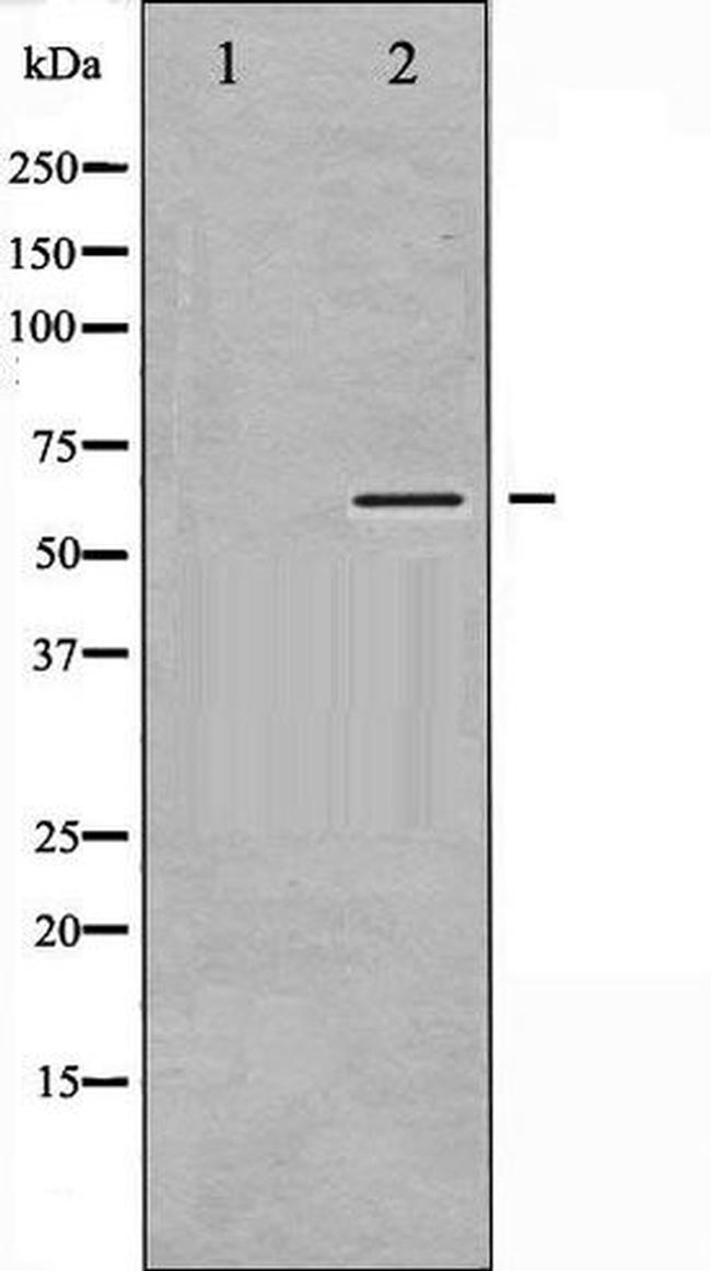 Phospho-CaMKII (Thr305) Antibody in Western Blot (WB)