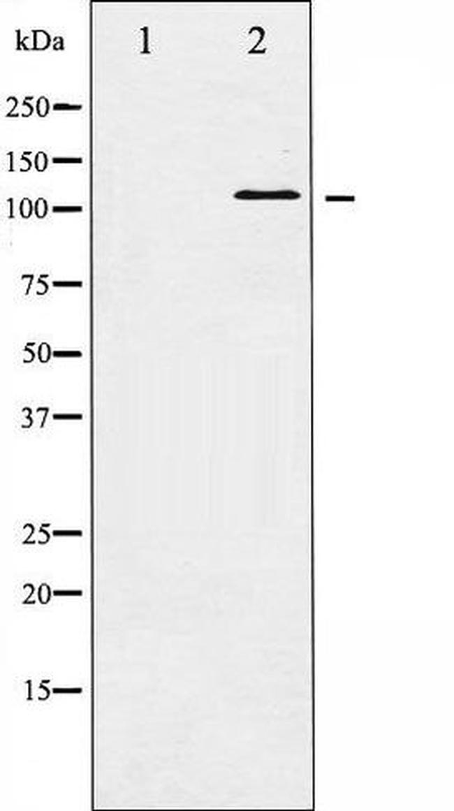 Phospho-HDAC5 (Ser498) Antibody in Western Blot (WB)