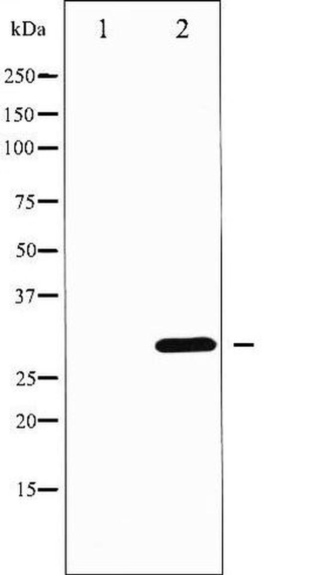 Phospho-DARPP-32 (Thr75) Antibody in Western Blot (WB)