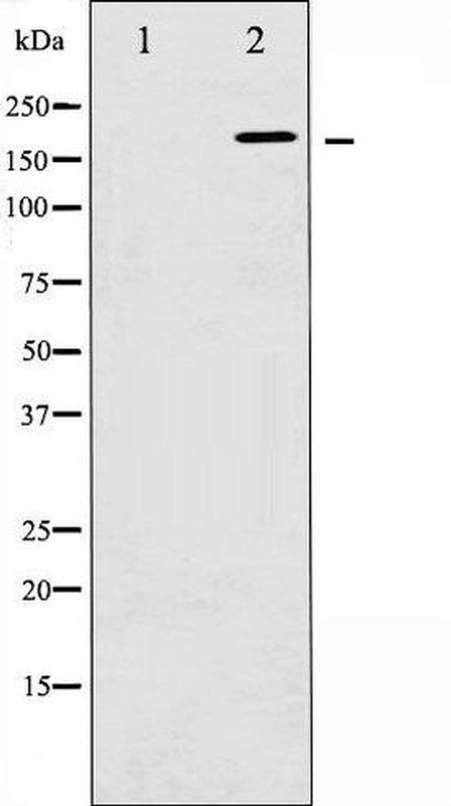 Phospho-WNK1 (Thr58) Antibody in Western Blot (WB)