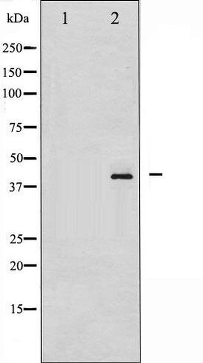 Phospho-HDAC8 (Ser39) Antibody in Western Blot (WB)