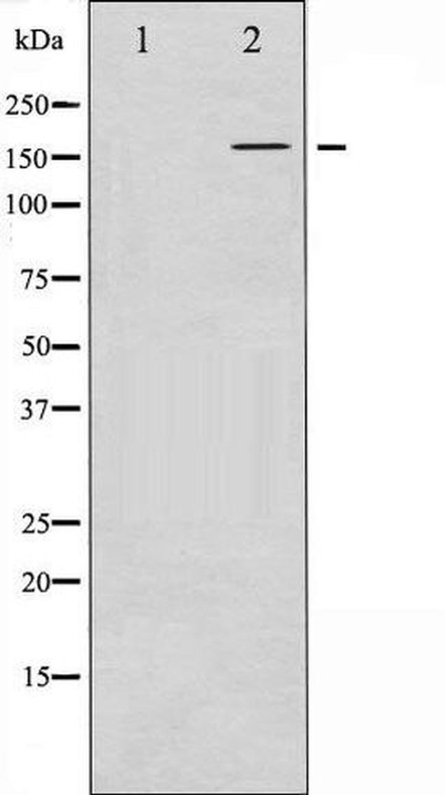 Phospho-FANCD2 (Ser222) Antibody in Western Blot (WB)