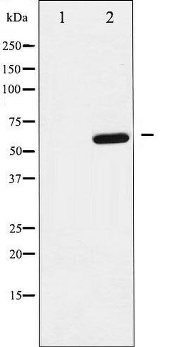 Phospho-p62 Dok (Tyr398) Antibody in Western Blot (WB)