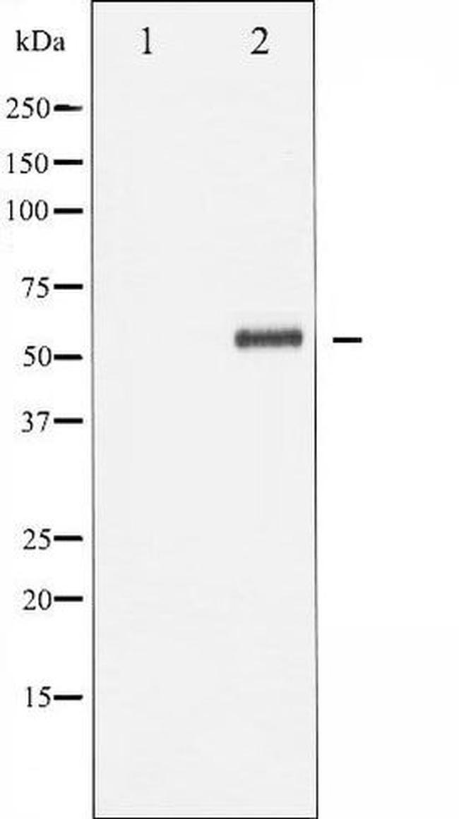 Phospho-p62 Dok (Tyr362) Antibody in Western Blot (WB)