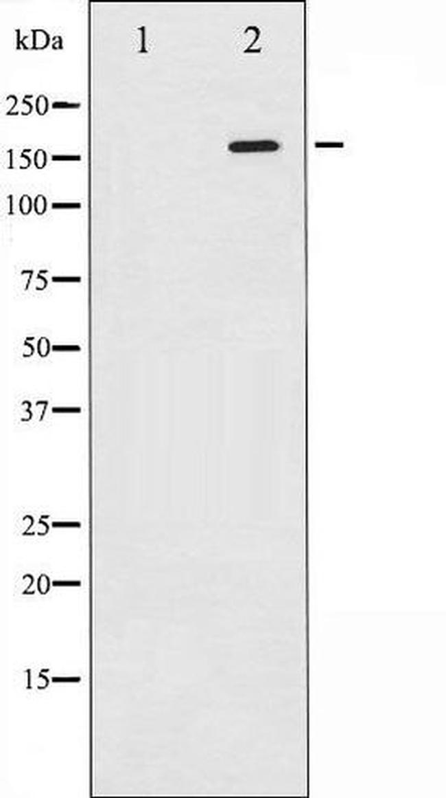 Phospho-ASK1 / MAP3K5 (Ser966) Antibody in Western Blot (WB)