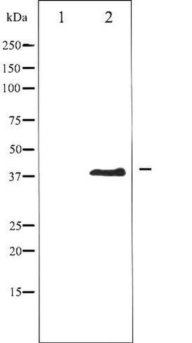 Phospho-Aurora B (Thr232) Antibody in Western Blot (WB)