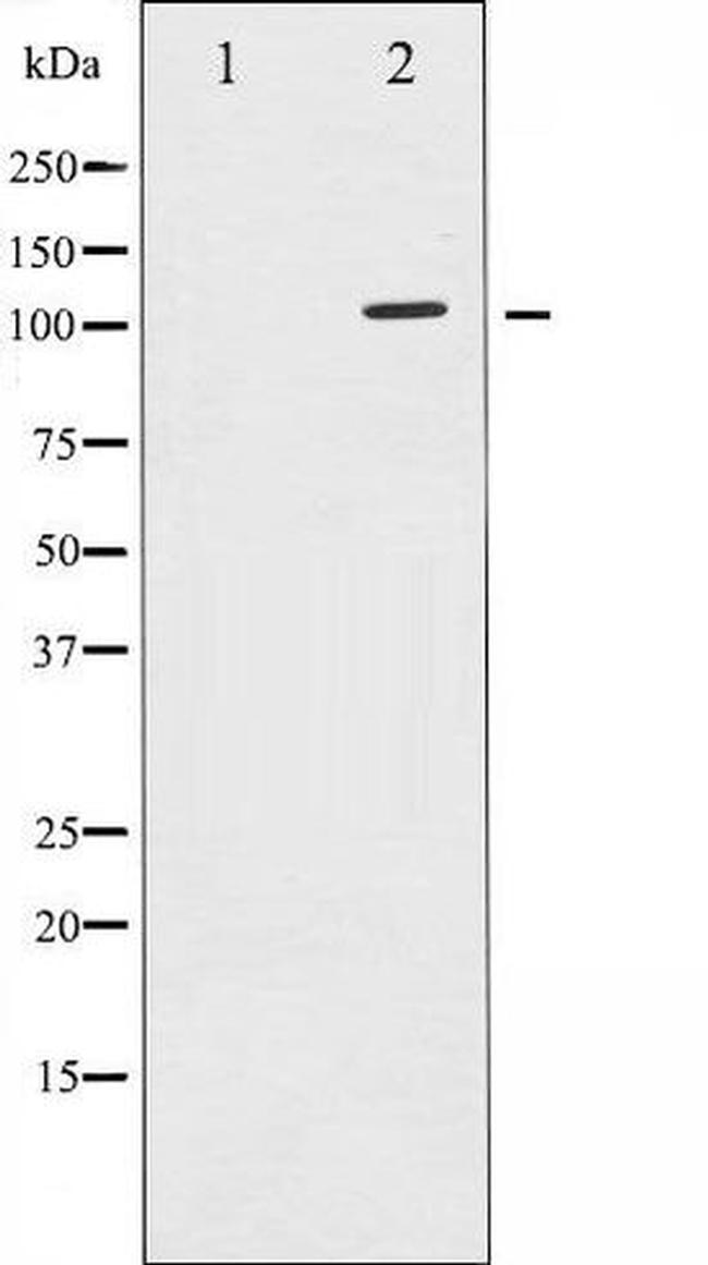 Phospho-SirT1 (Ser47) Antibody in Western Blot (WB)