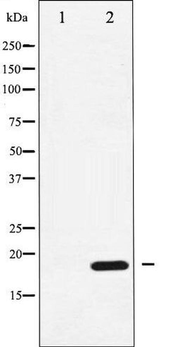 Phospho-CPI-17 (Thr38) Antibody in Western Blot (WB)