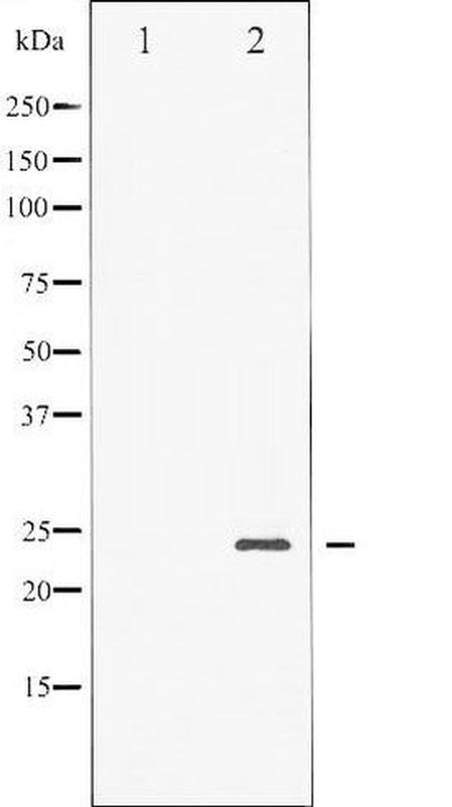 Phospho-BAD (Ser136) Antibody in Western Blot (WB)