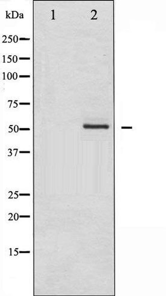 Phospho-HDAC2 (Ser394) Antibody in Western Blot (WB)