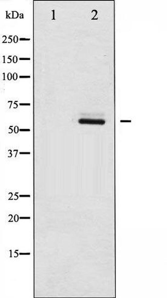 Phospho-Estrogen Receptor beta (Ser105) Antibody in Western Blot (WB)