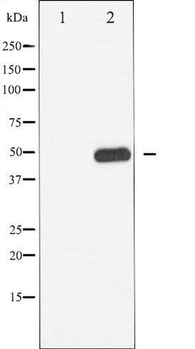 Phospho-BLNK (Tyr96) Antibody in Western Blot (WB)