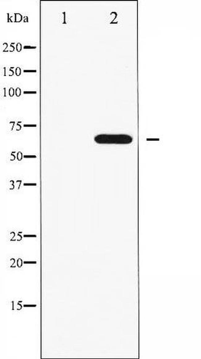 Phospho-FRS2 (Tyr436) Antibody in Western Blot (WB)