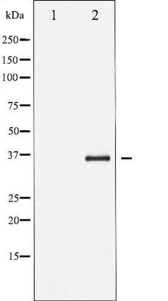 Phospho-I kappa-B-beta (Thr19) Antibody in Western Blot (WB)
